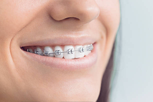 Best Dental Fillings (Composite and Amalgam)  in Heceta Beach, OR